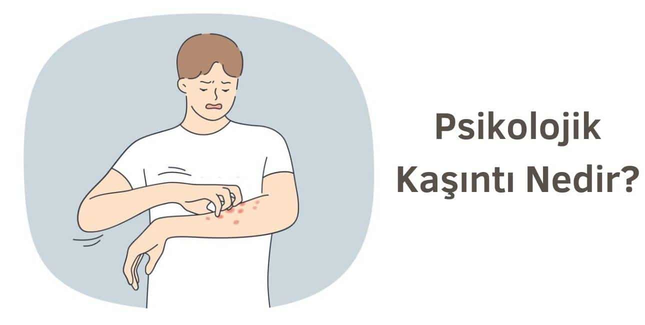 psikolojik kaşıntı nasıl geçer